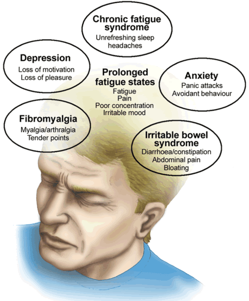 chronic fatigue syndrome