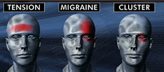 Headache migraine specialist