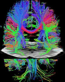 Genetics and Mental Health